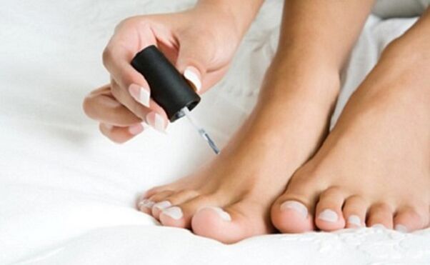 Nagelpilz heilen Lack